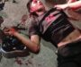Camioneta impacta a motociclista y lo deja al borde de la muerte en Minatitlán